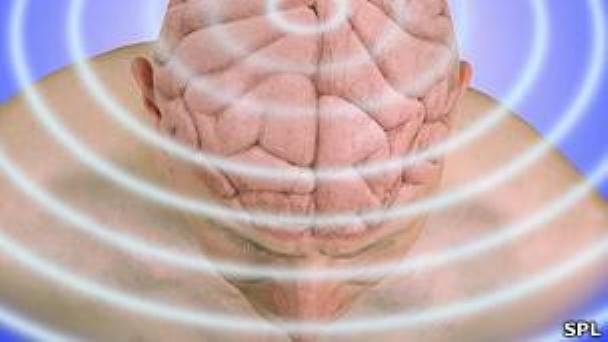 cerebro-stimulacion-elf-emf-rnm